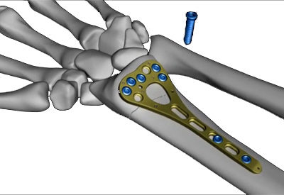 Medical Animation