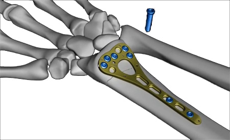 Medical Animation